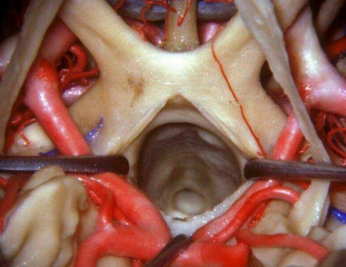 Close up view of Optic chiasma