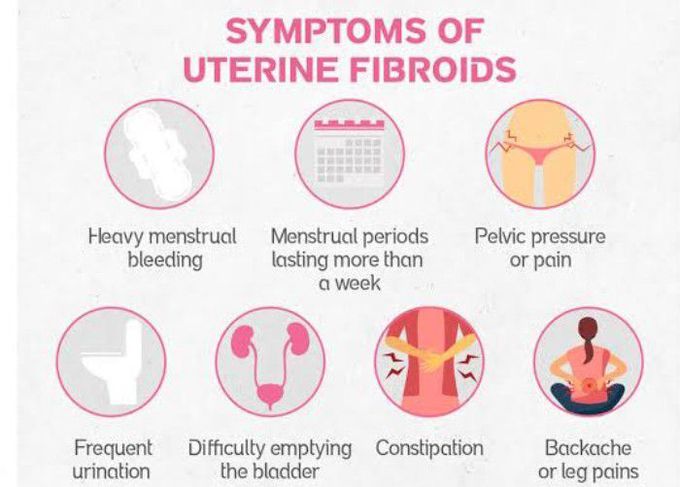 Symptoms of Uterine fibroids