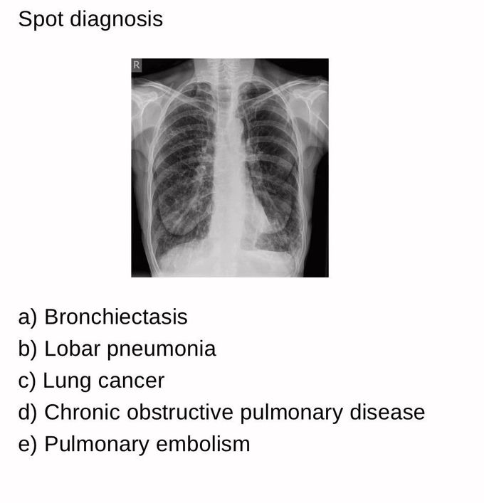 Spot Diagnosis