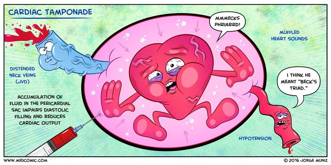 Cardiac tamponade