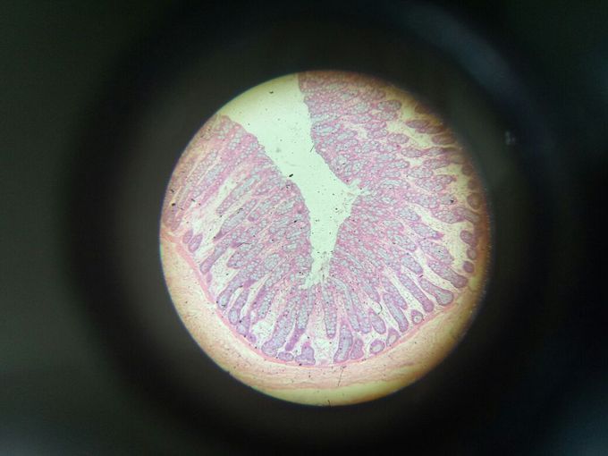 Cross section of ileum
