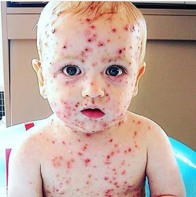 Spot Diagnosis?