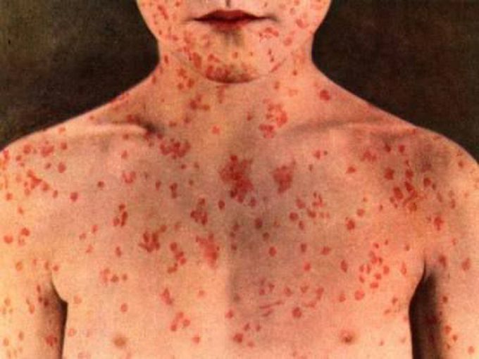Diagnosis needed??