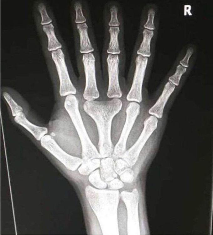 What is the name of this condition??