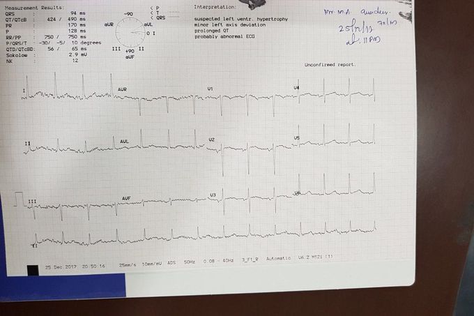 ECG report