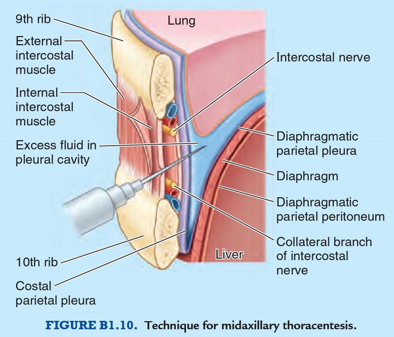 thoracentesis anatomy