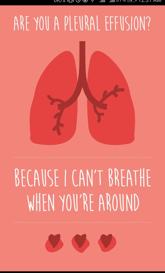 Pleural effusion