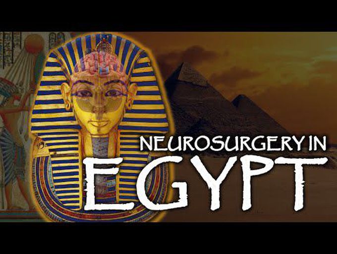 Ancient Egyptian Neurosurgery