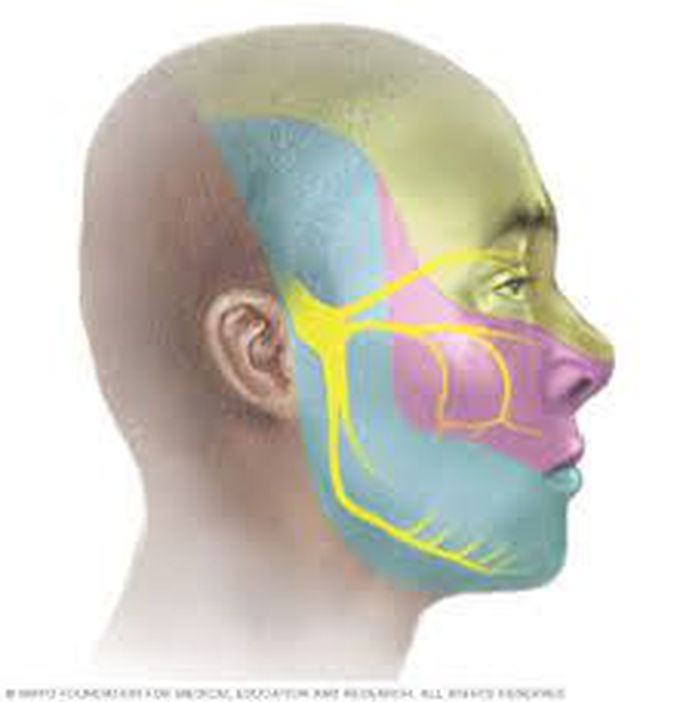 Symptoms of trigeminal neuralgia