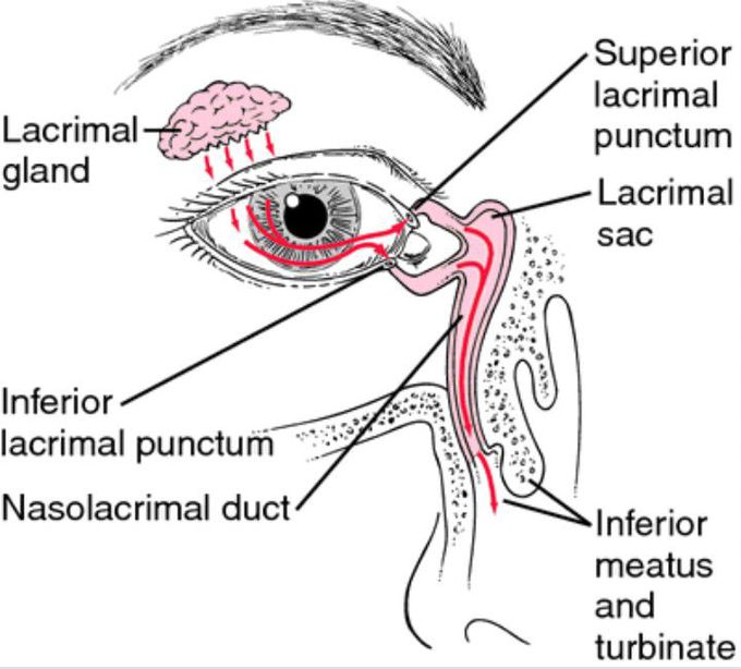 Dacrocystitis