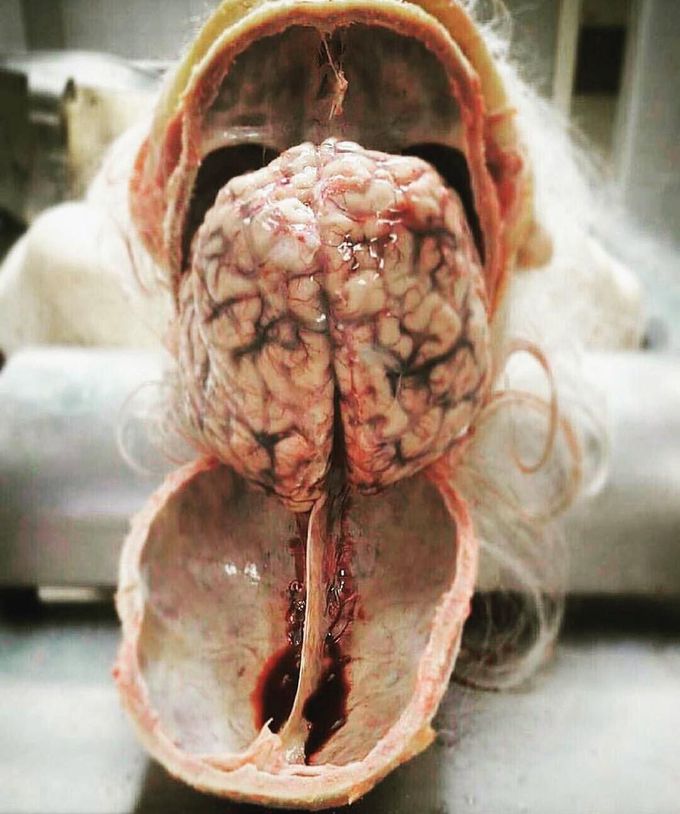 Human central nervous system beautifully dissected