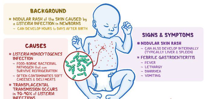 Cause of Listeriosis