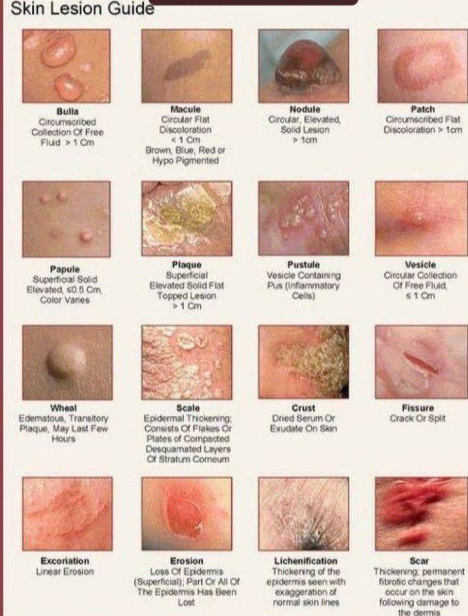 Skin lesions guide