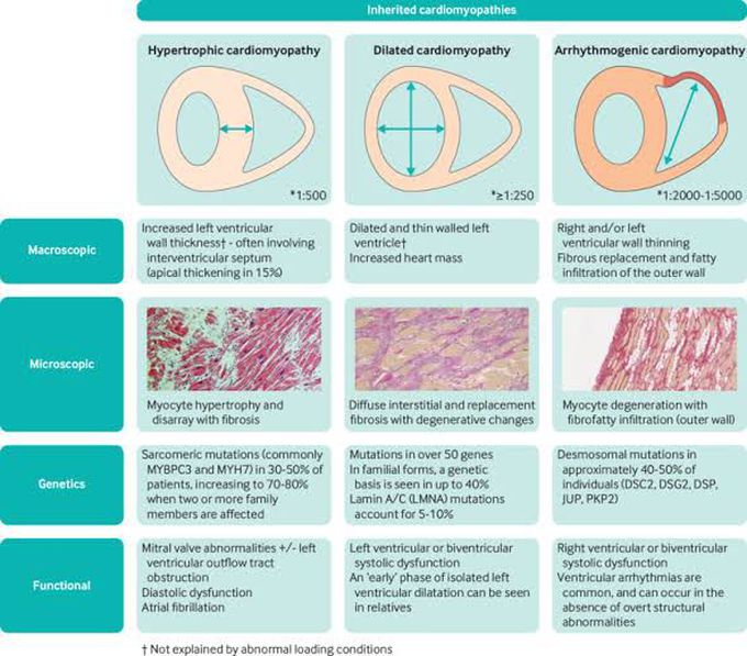 Inherited Cardiomyopathy