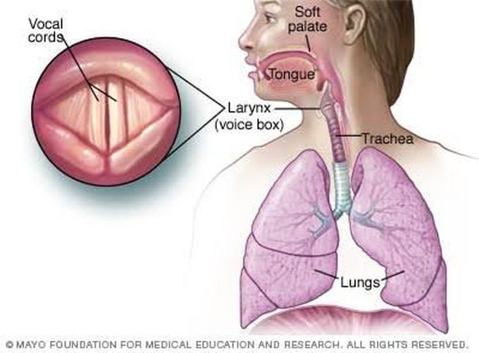 Laryngitis