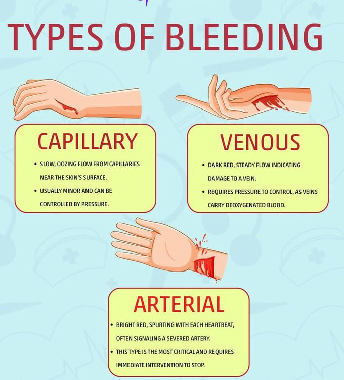 Types of Bleeding