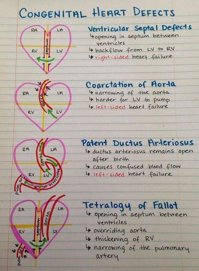 Understanding Of Heart Diseases