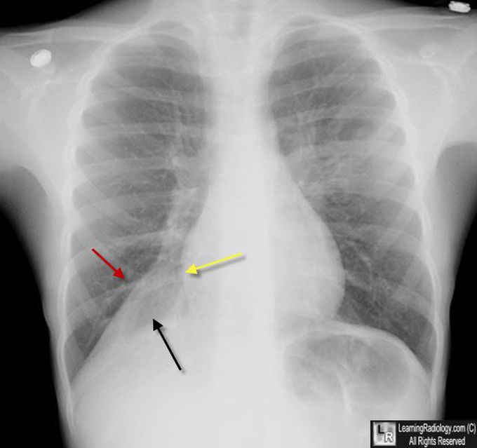 What's your diagnosis??