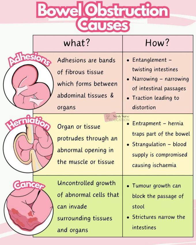 Bowel Obstruction - Causes