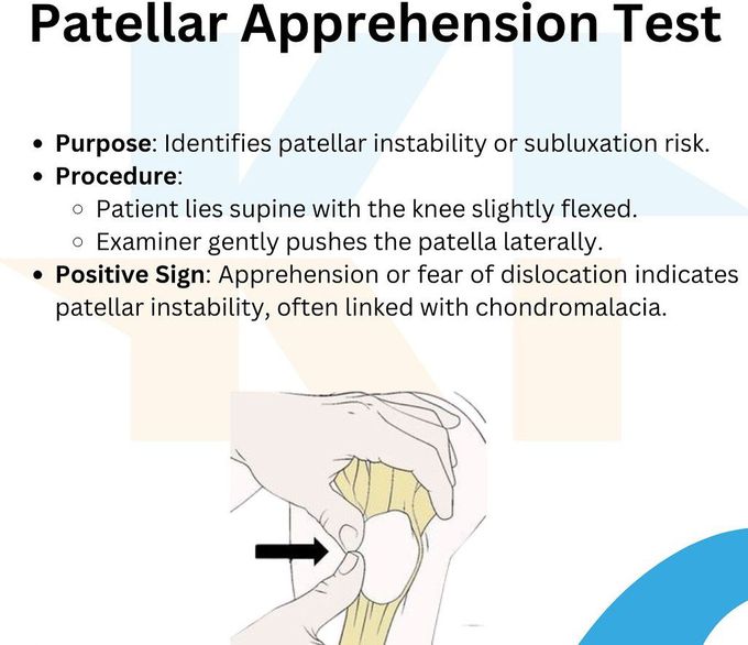 Patellar Appression Test