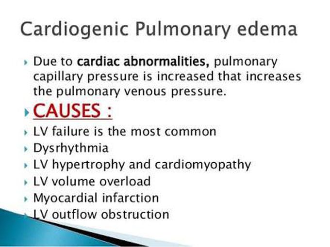 This is Acute Left Ventricular Failure