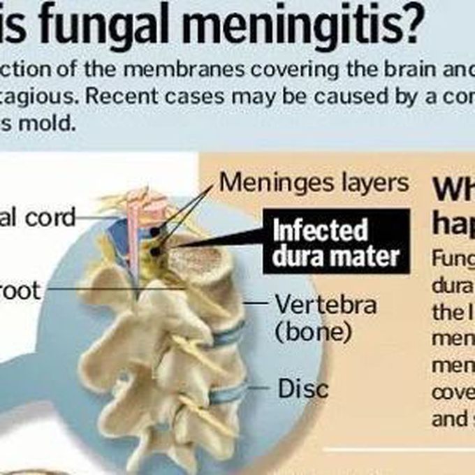 Meninges