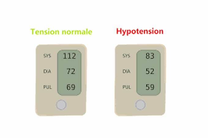 Treatment of hypotension