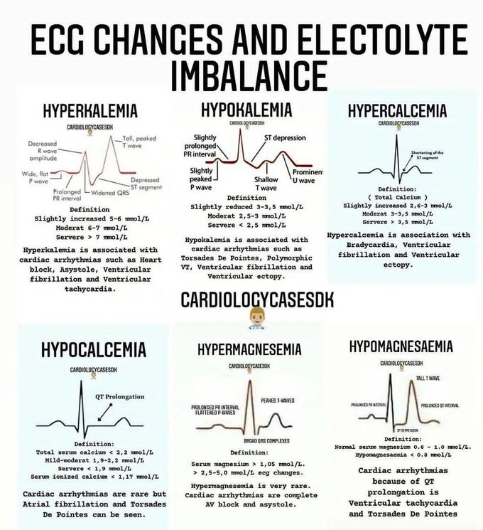 ECG Changes and Electrolyte Imbalance