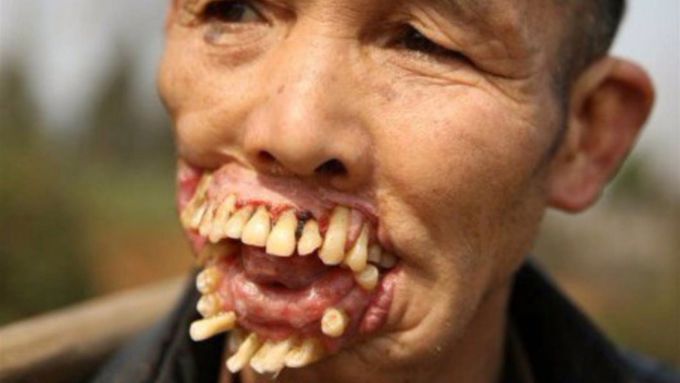 10 Scariest Diseases in the World
