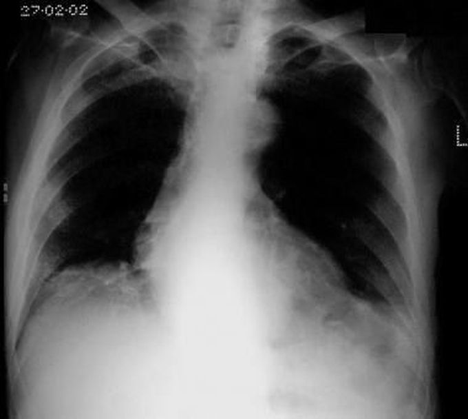 What is your diagnosis??????