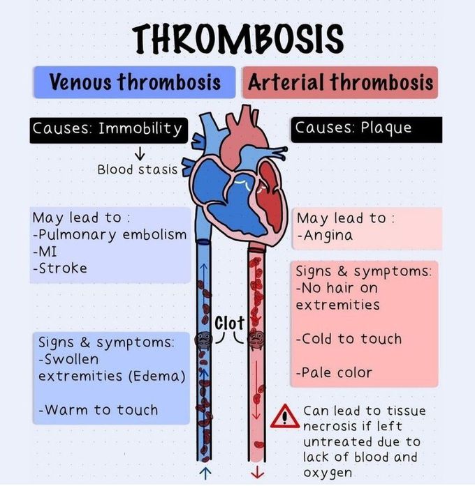 Thrombosis