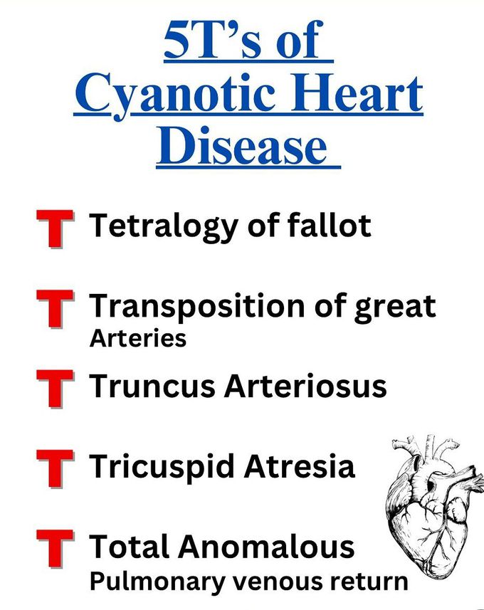 Cyanotic Heart Disease- Mnemonic