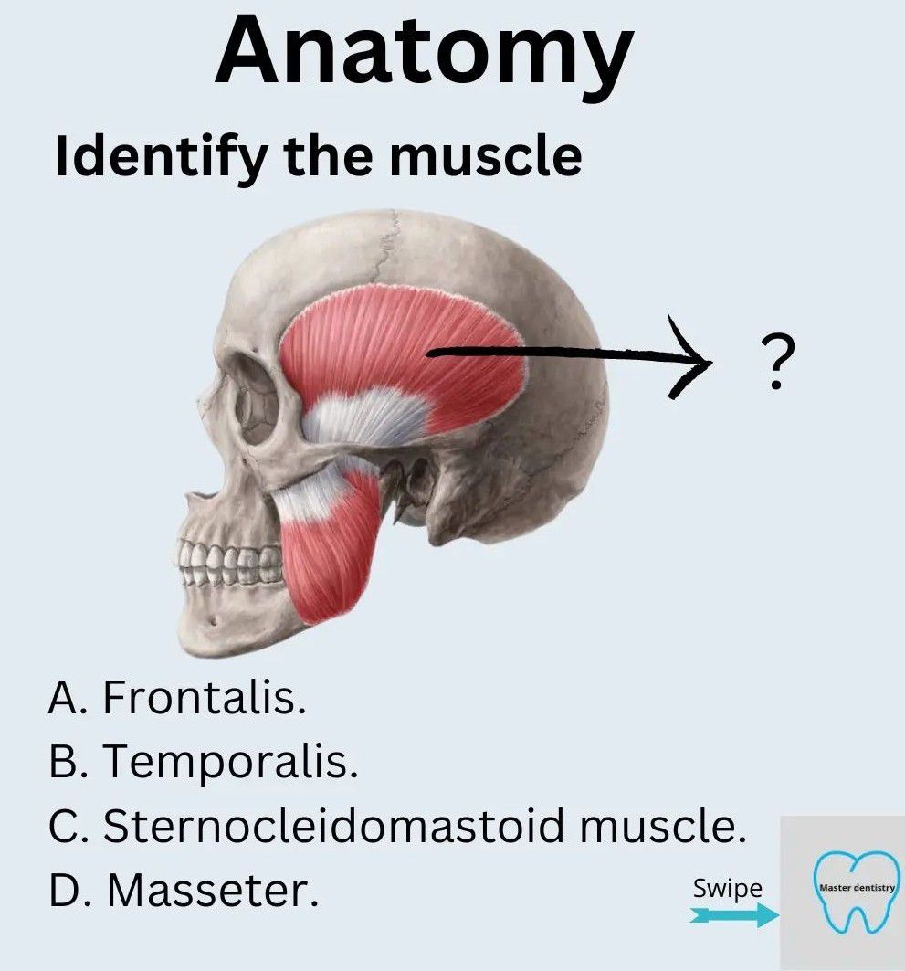 Identify the Muscle - MEDizzy