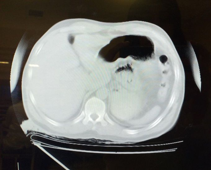 What is your diagnosis?