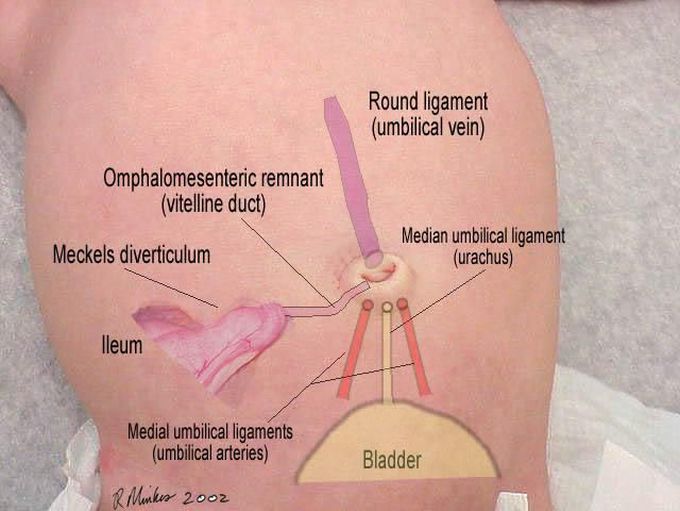 Anatomic relationship between the umbilicus and its embryologic attachments.