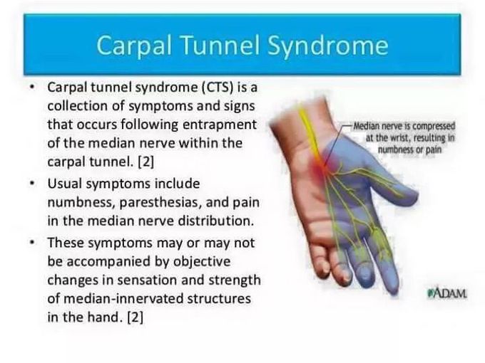 Carpel tunnel syndrome
