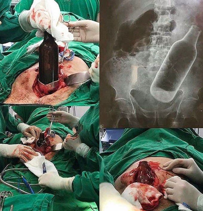 That's shoked 😑 , what is your reaction after reading it ??