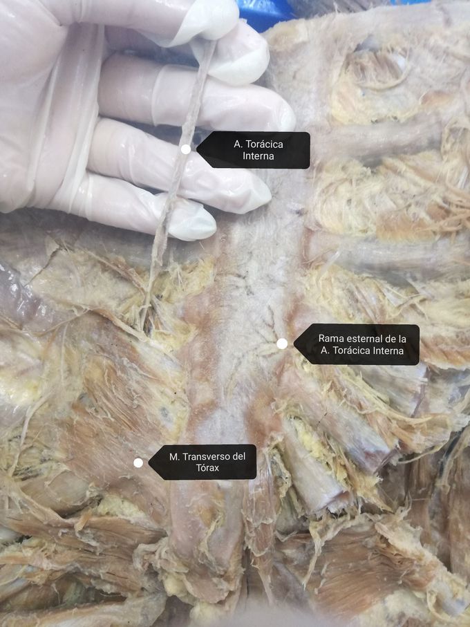 Parte posterior del esternón