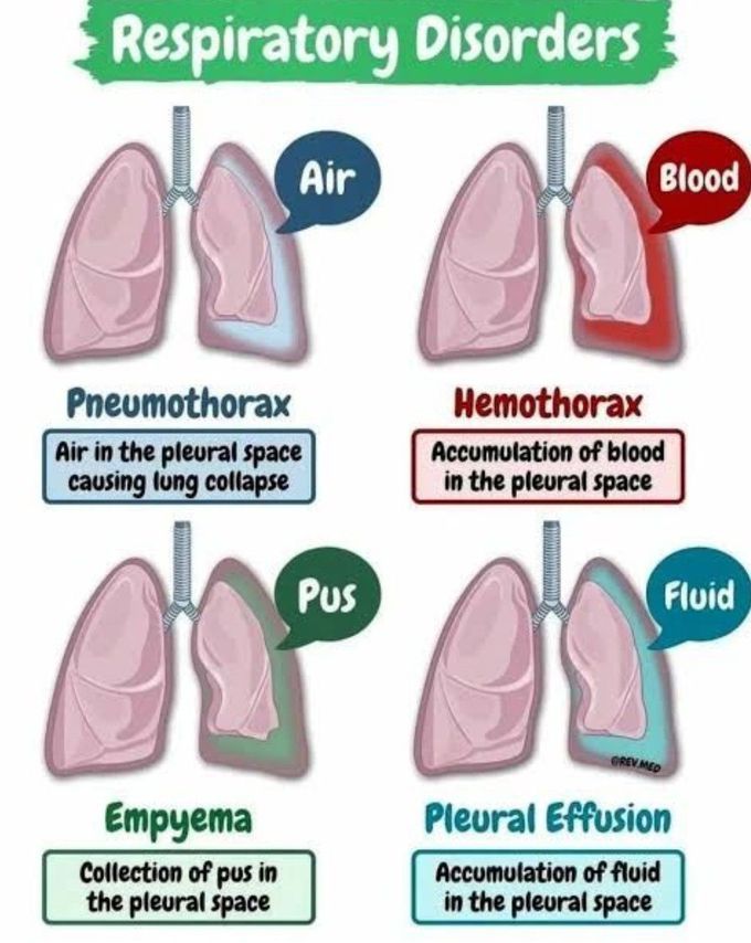 Respiratory Disorders