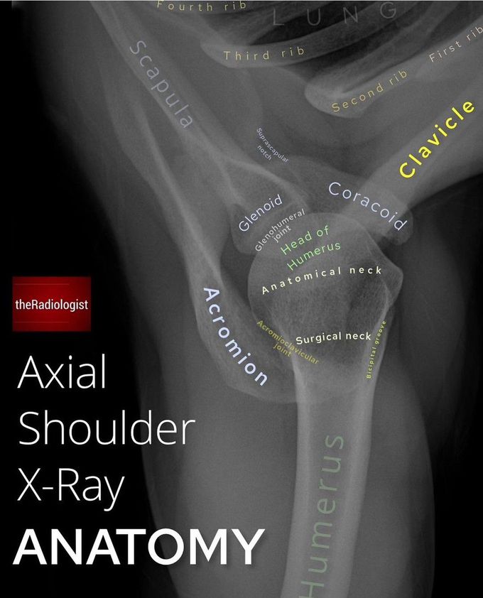 Upper Limb Anatomy VI