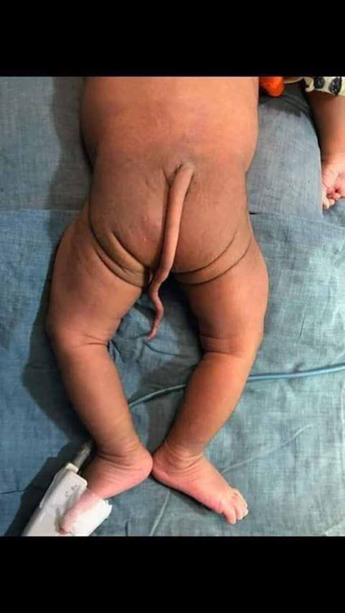 Vistigial tail