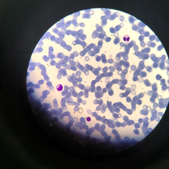 Blood cells