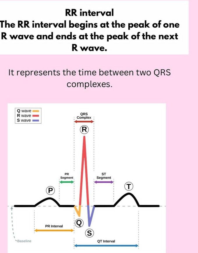 RR Interval