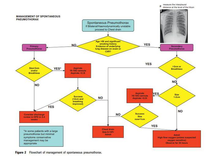 Algorithm For Management of Spontaneous Pneumothorax
