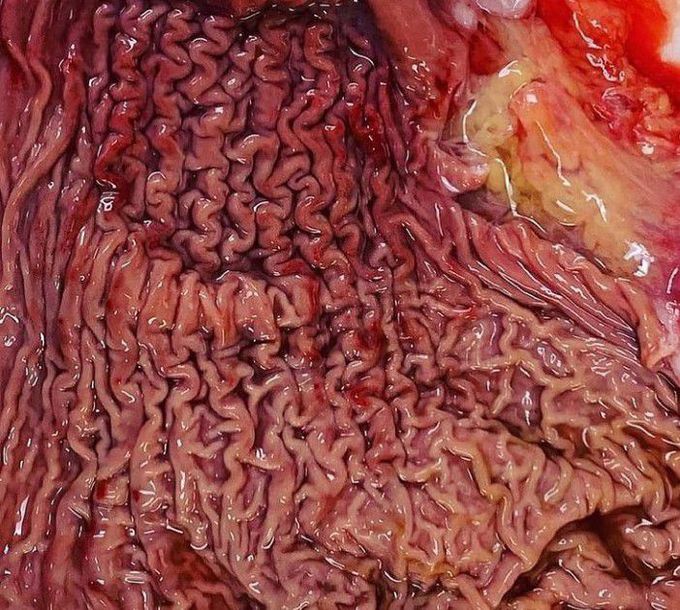 The internal structure of the stomach