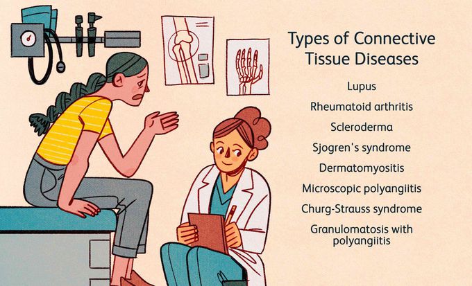 Types of connective tissue diseases - MEDizzy