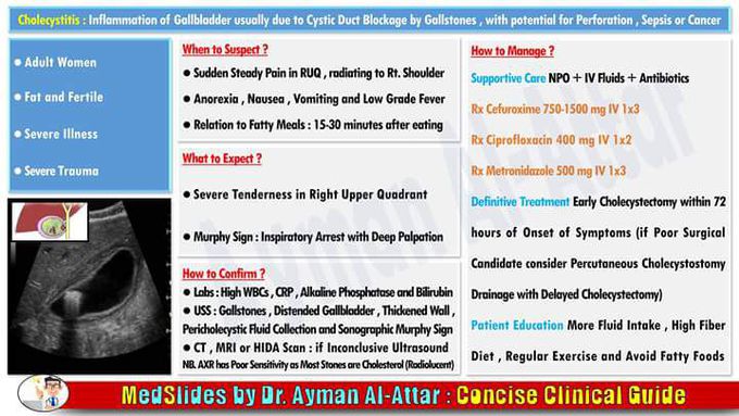Cholecystitis