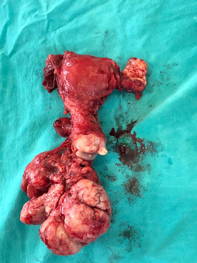 What’s the diagnosis?