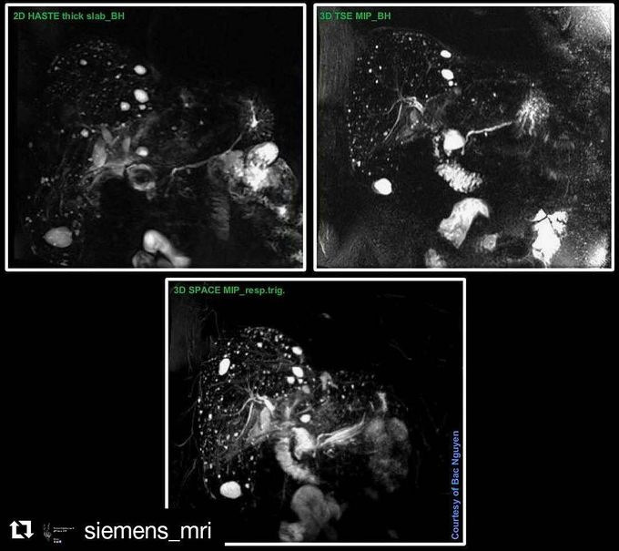 Different approach to visualize the bile duct system