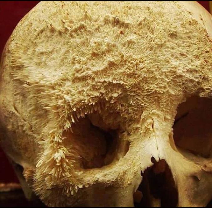 What is your diagnosis 😏???